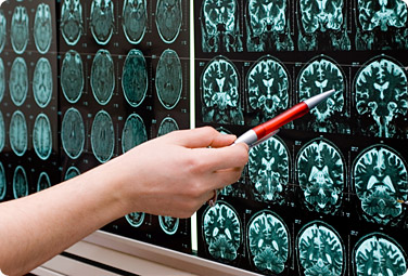 MRI brain scans being analyzed